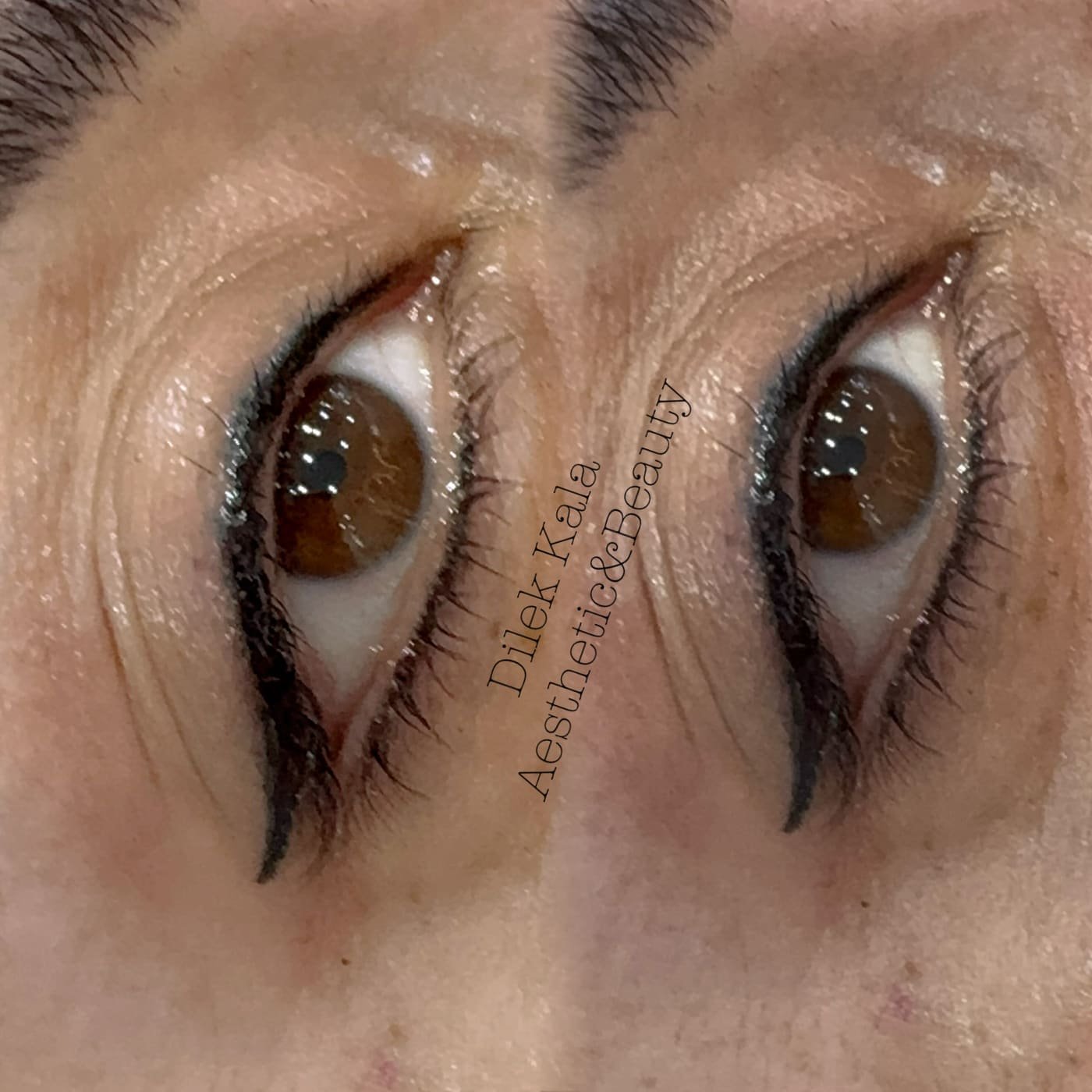 Treatment result 15
