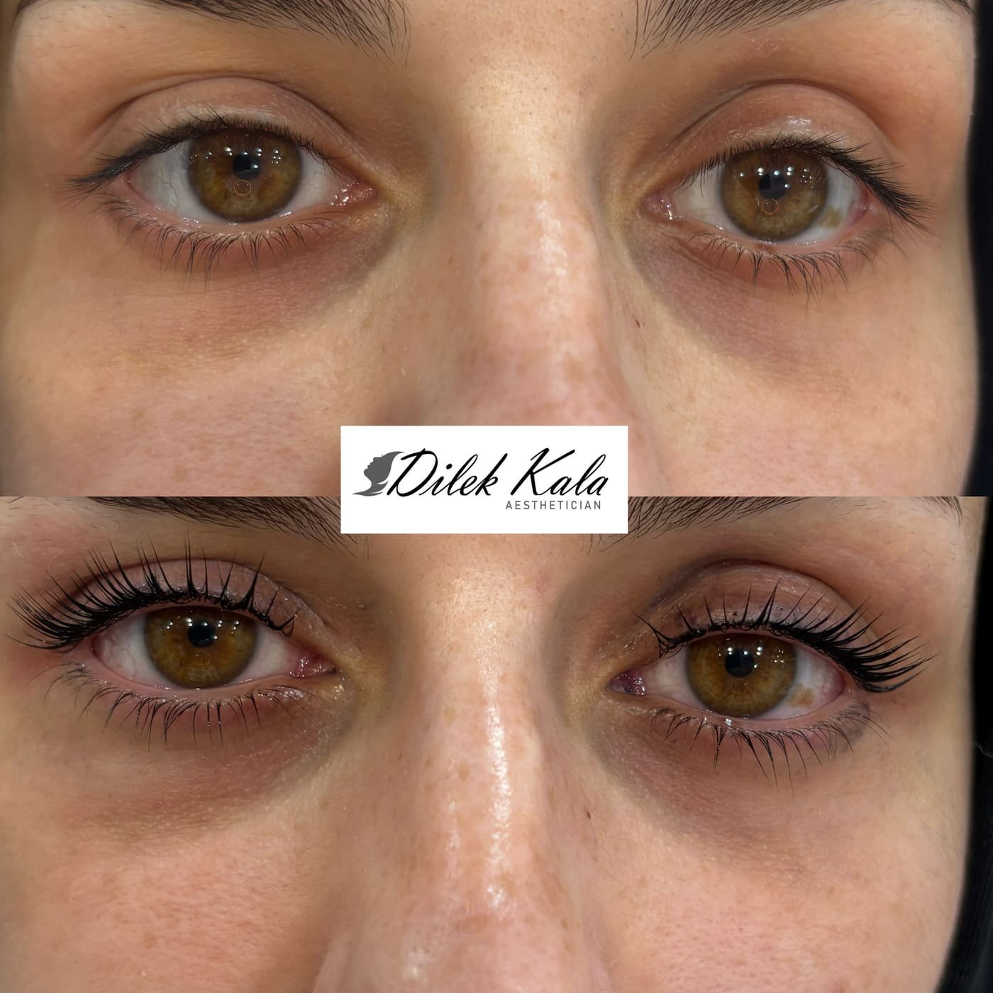 Treatment result 19