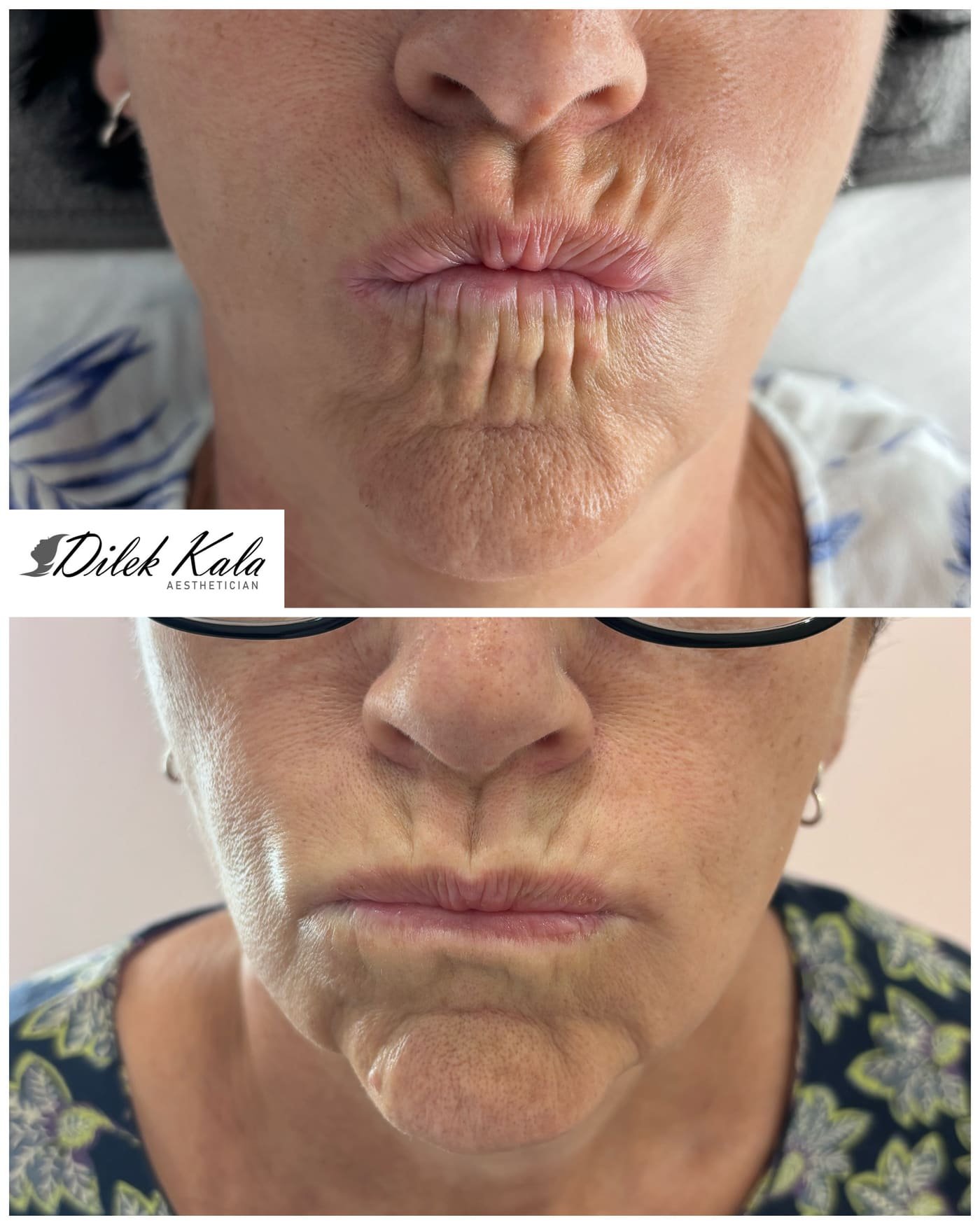 Treatment result 2