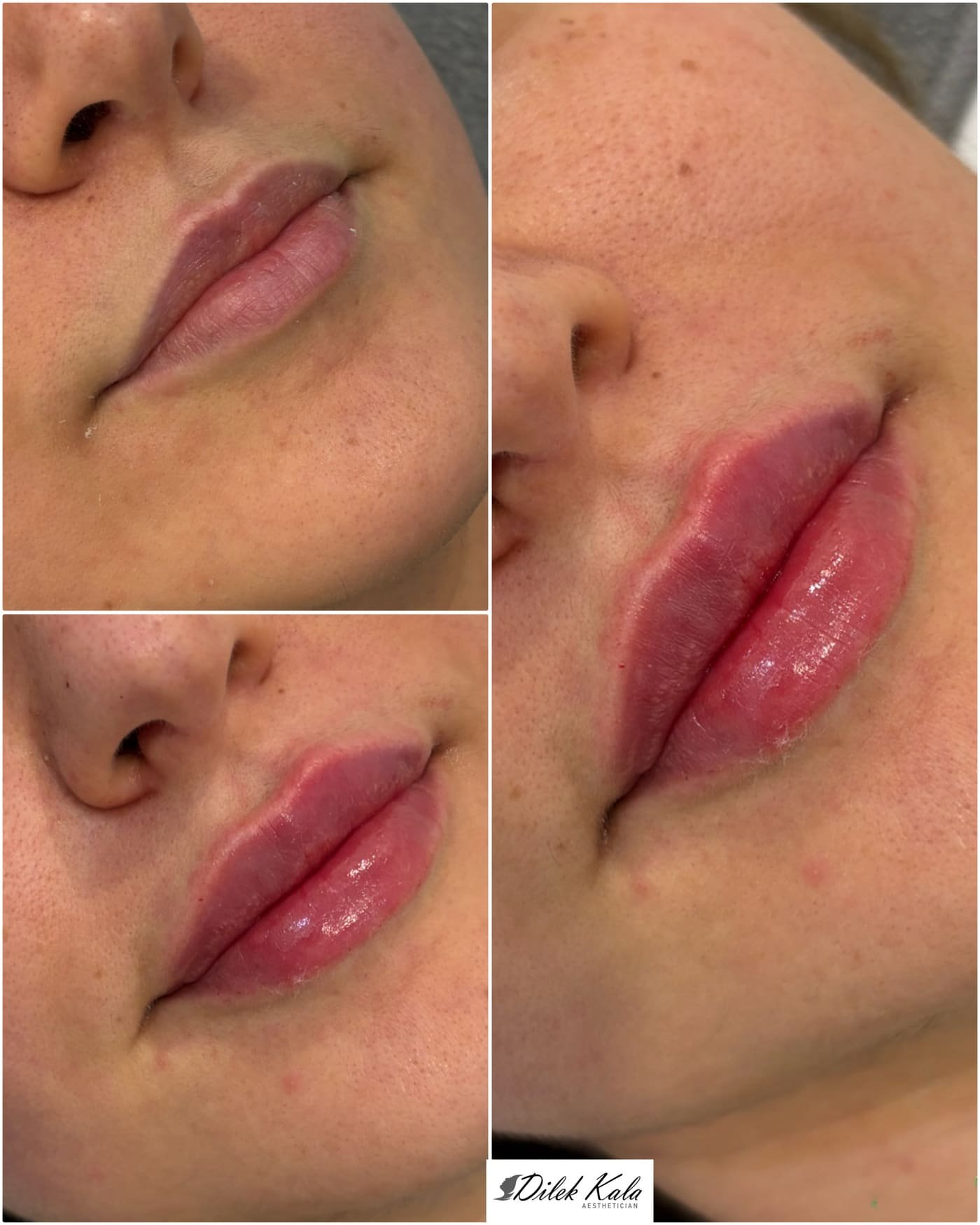 Treatment result 22