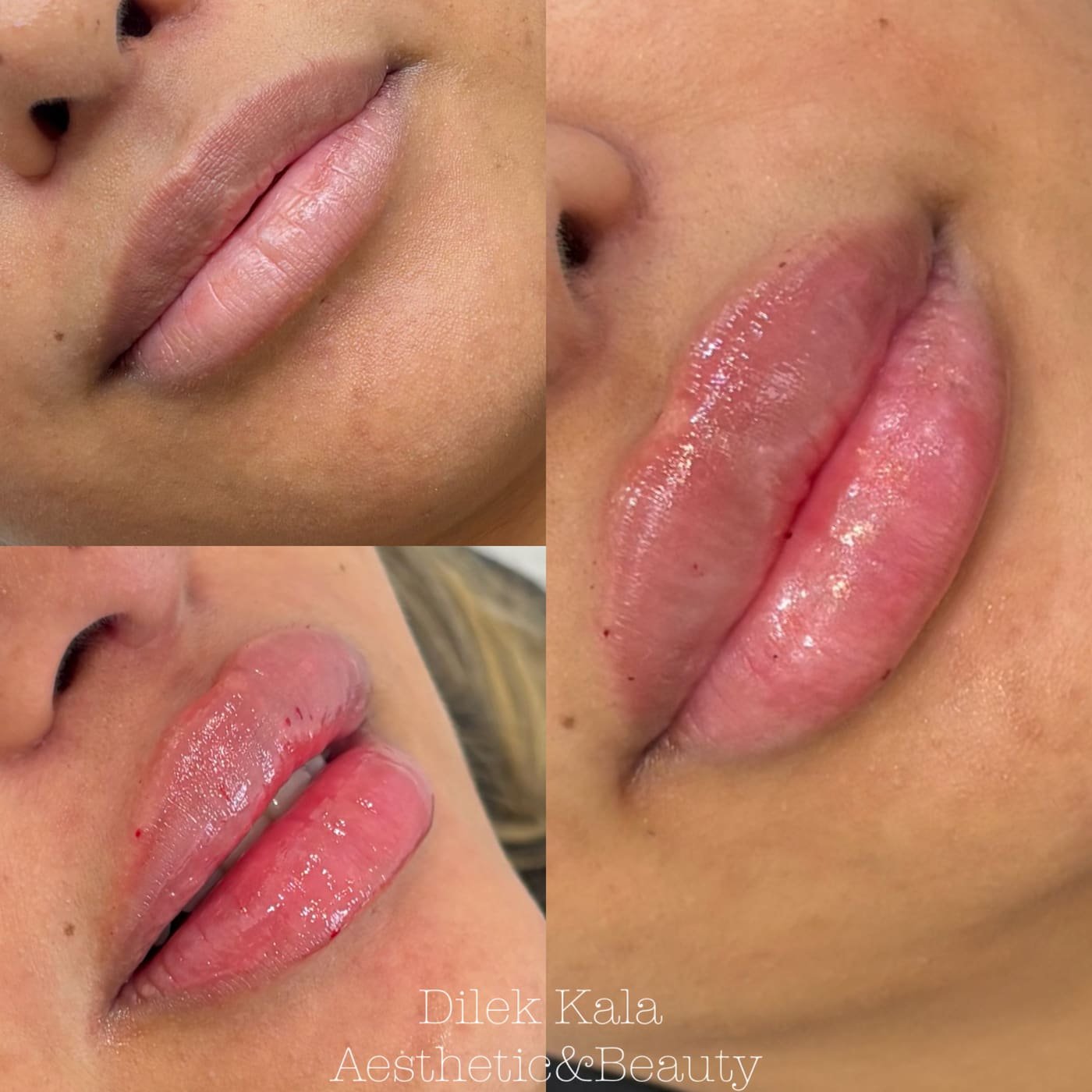 Treatment result 25