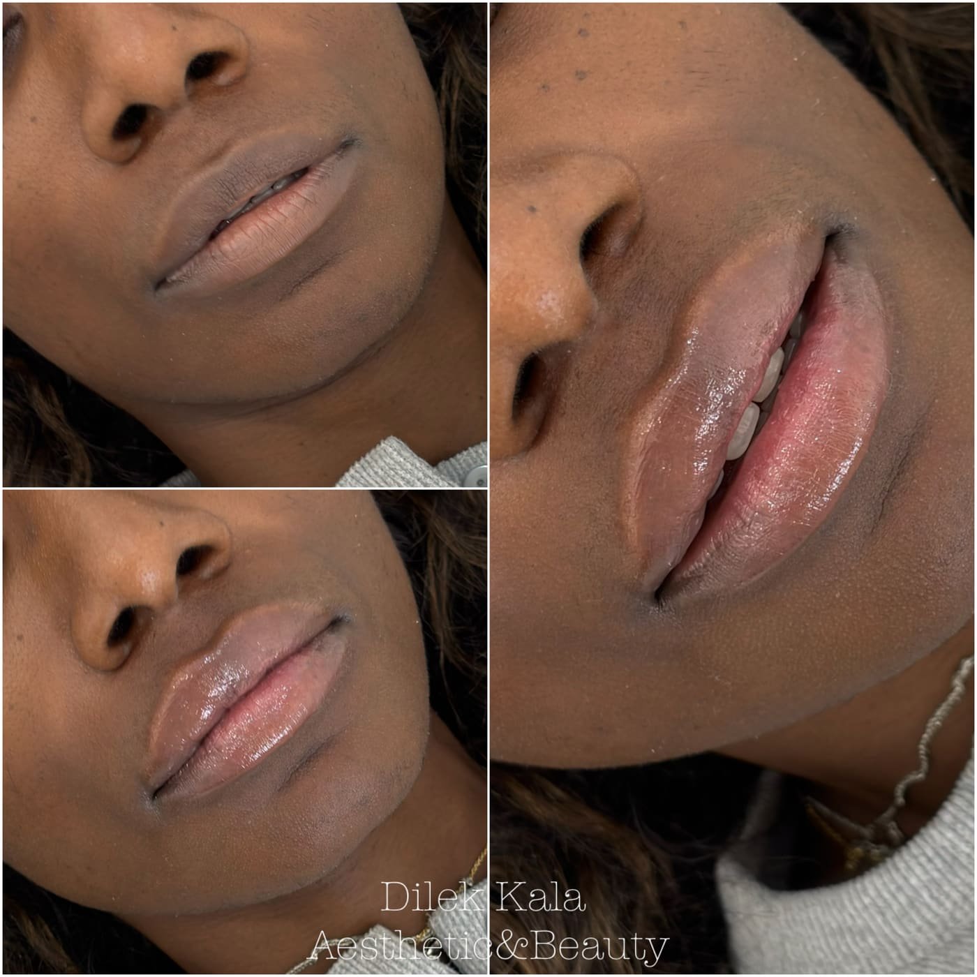 Treatment result 26