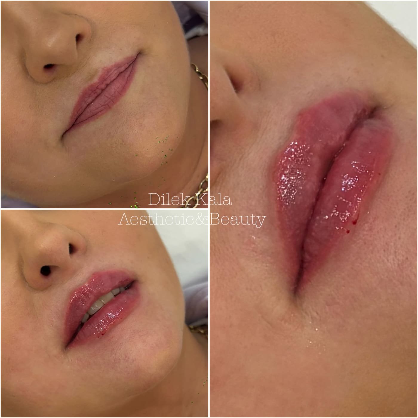 Treatment result 27