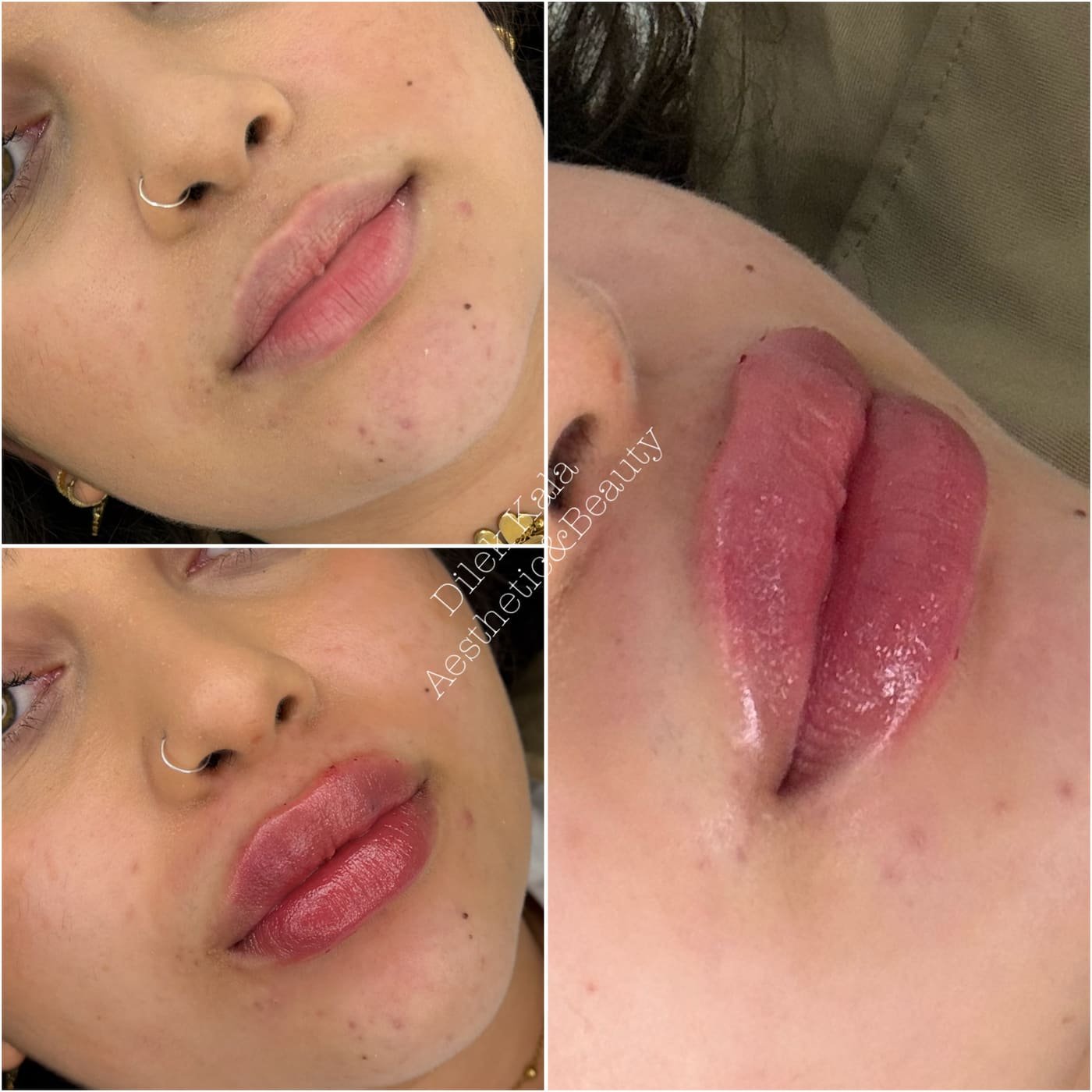 Treatment result 28