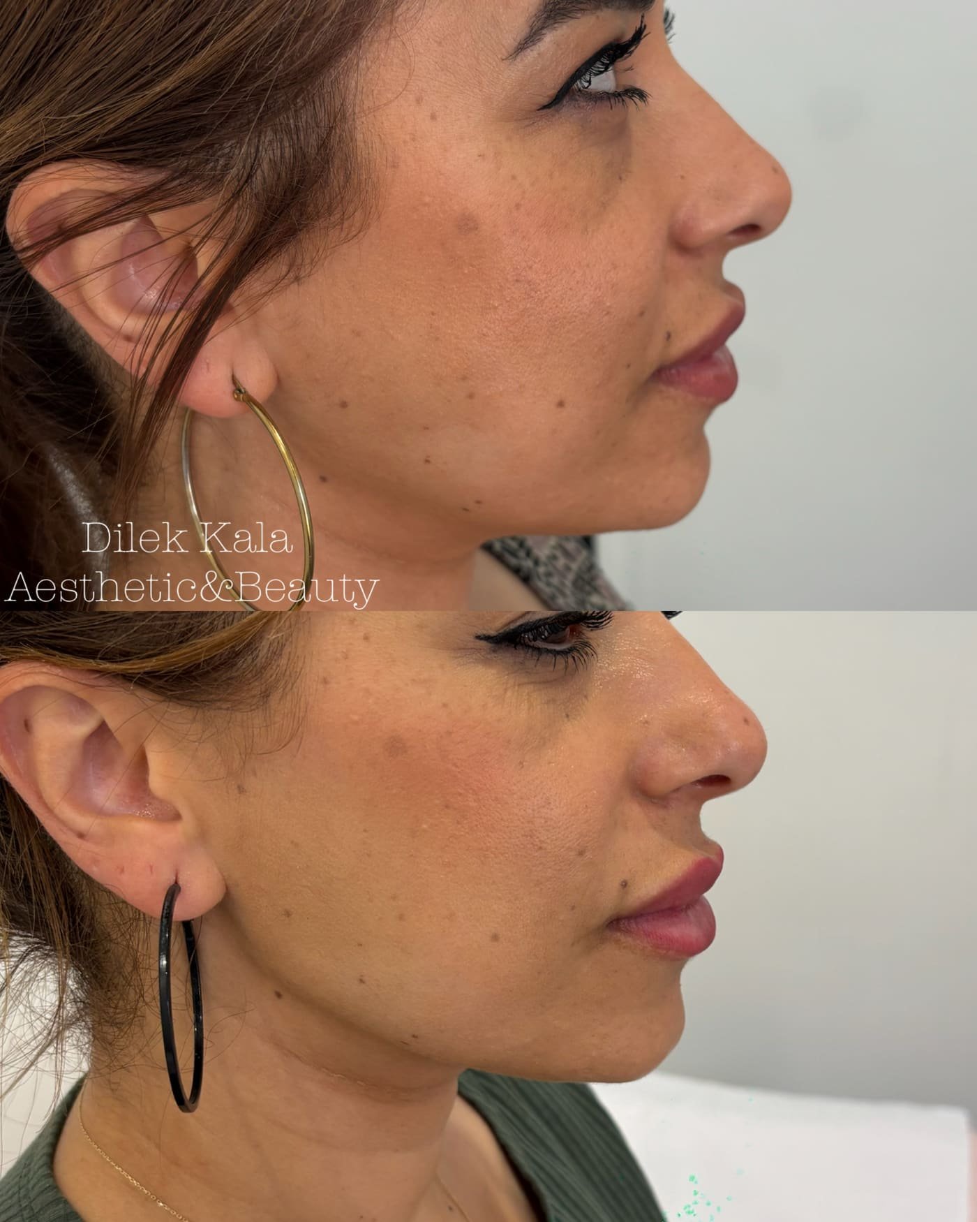 Treatment result 29