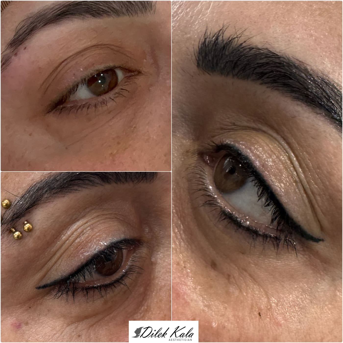 Treatment result 31