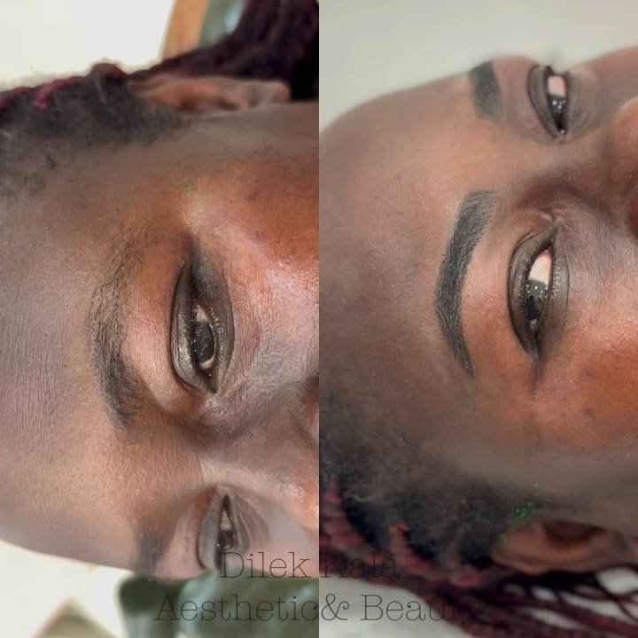 Treatment result 34
