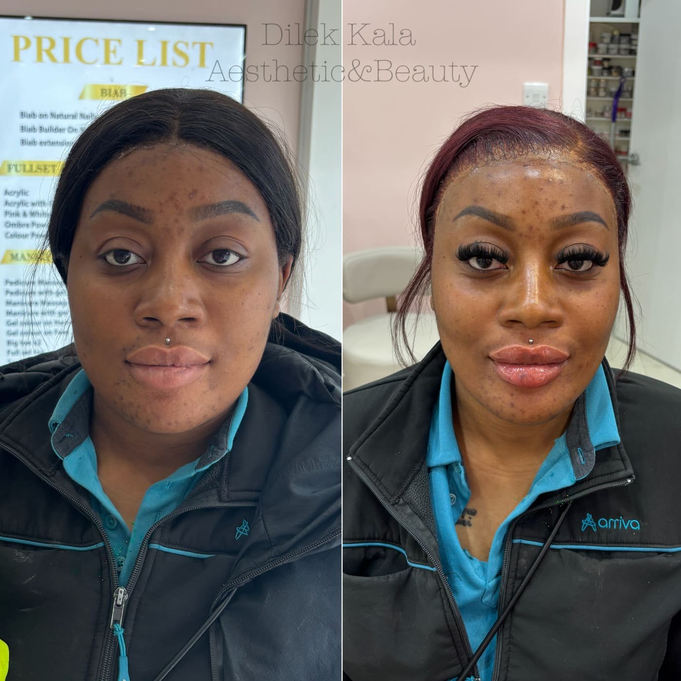 Treatment result 36