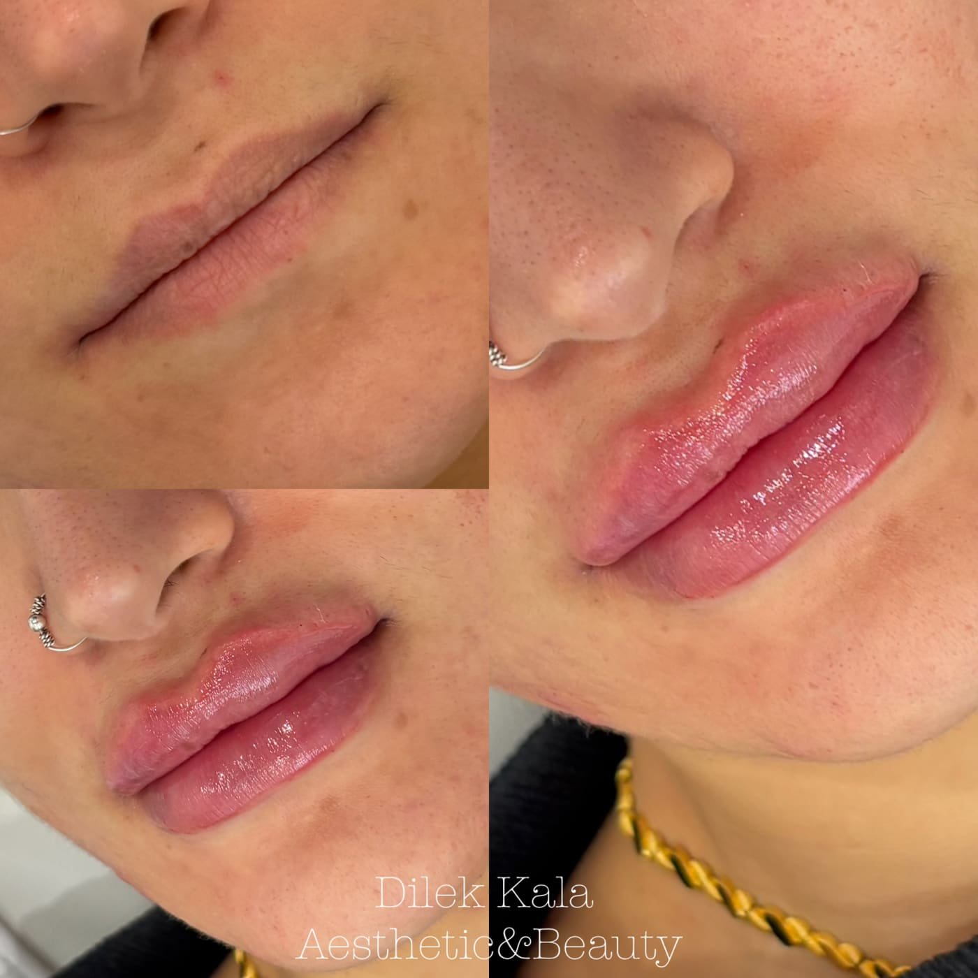 Treatment result 37