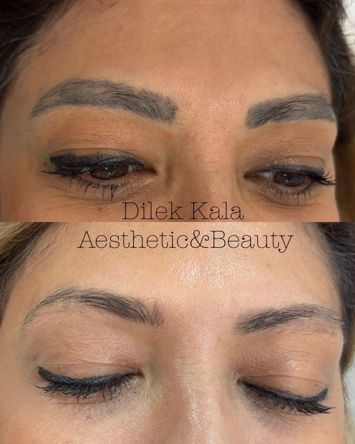 Treatment result 38