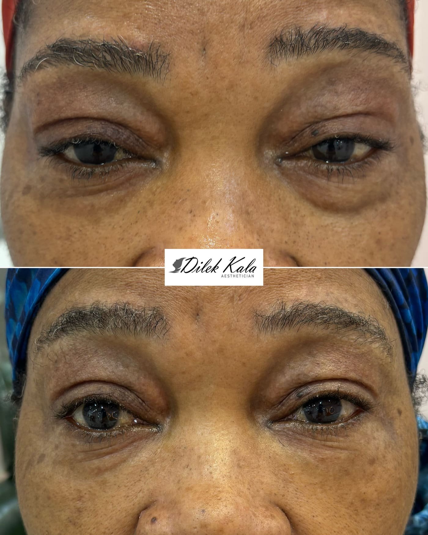 Treatment result 4