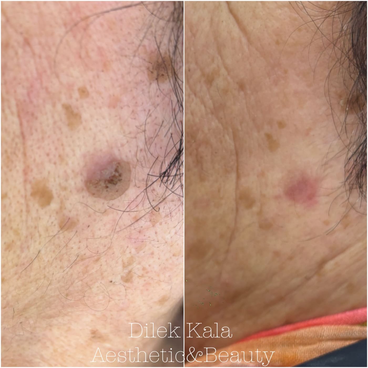 Treatment result 41
