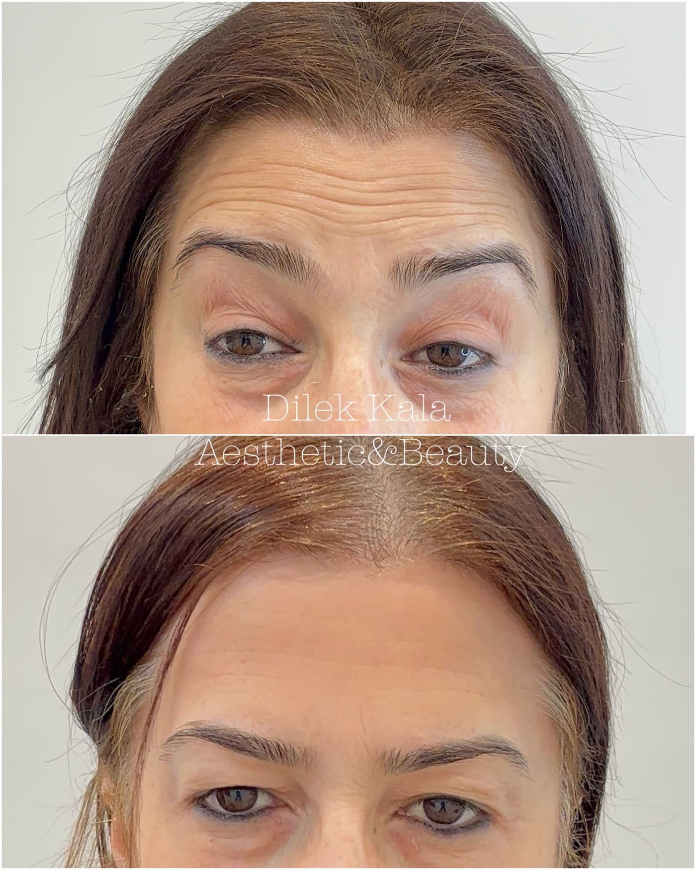 Treatment result 8