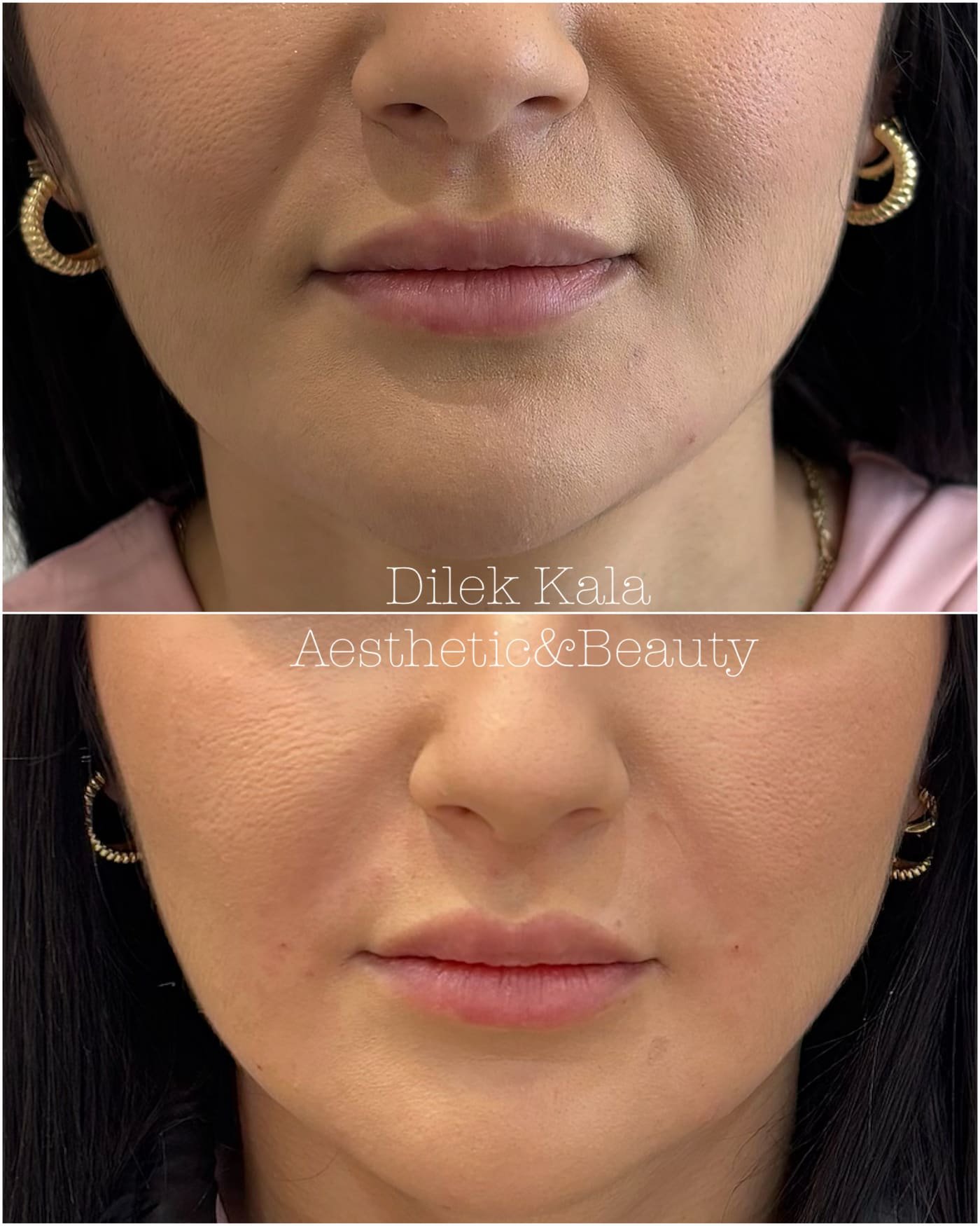 Treatment result 9